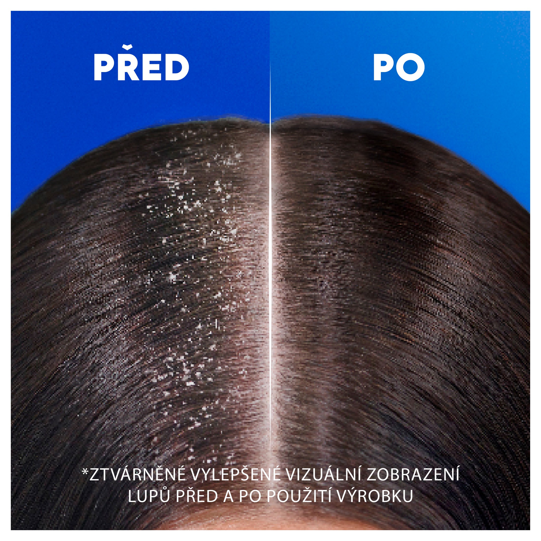 Head & Shoulders Smooth & Silky šampón proti lupinám 250 ml