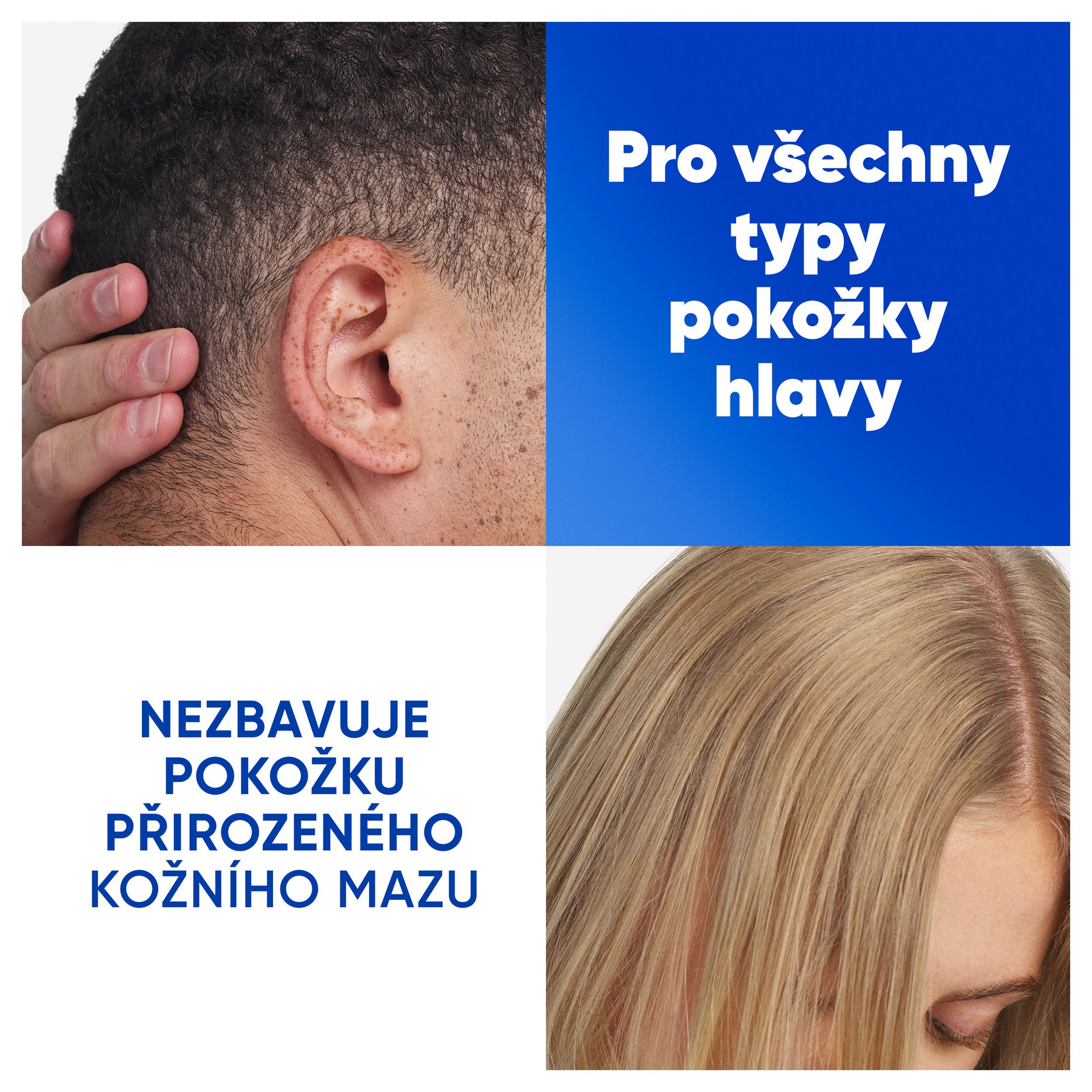 Head & Shoulders Apple Fresh šampón proti lupinám 250 ml