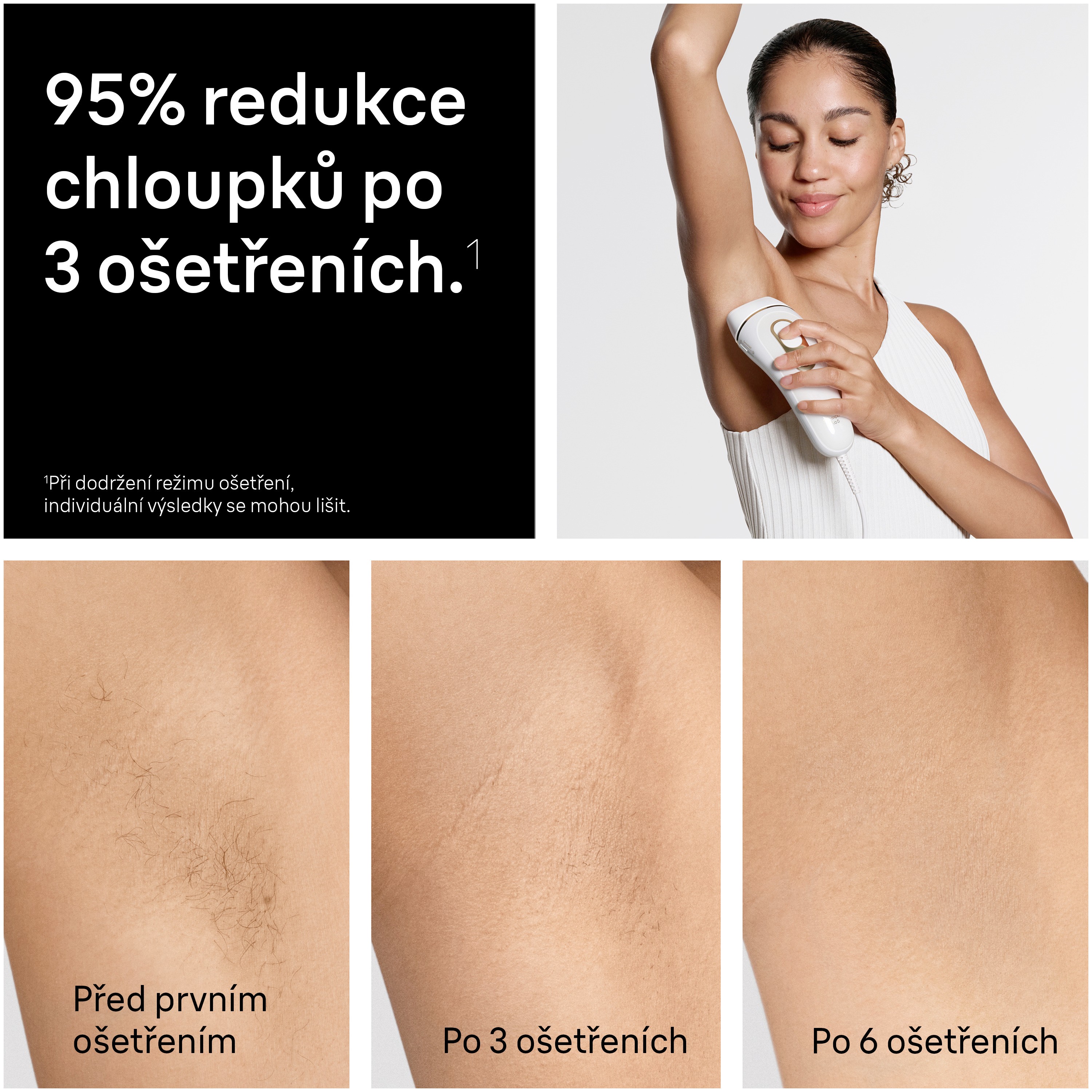 Braun Silk-expert Pro 5 PL5234 IPL epilátor
